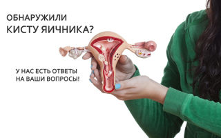 Чага при кисте яичника. Полезные свойства, рецепты, отзывы о березовом грибе чага при кисте яичников